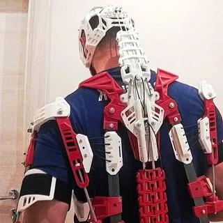 nozzle_torino
