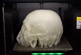 Human Skull with battle injuries (3D scan; Historiska Museet 260727)