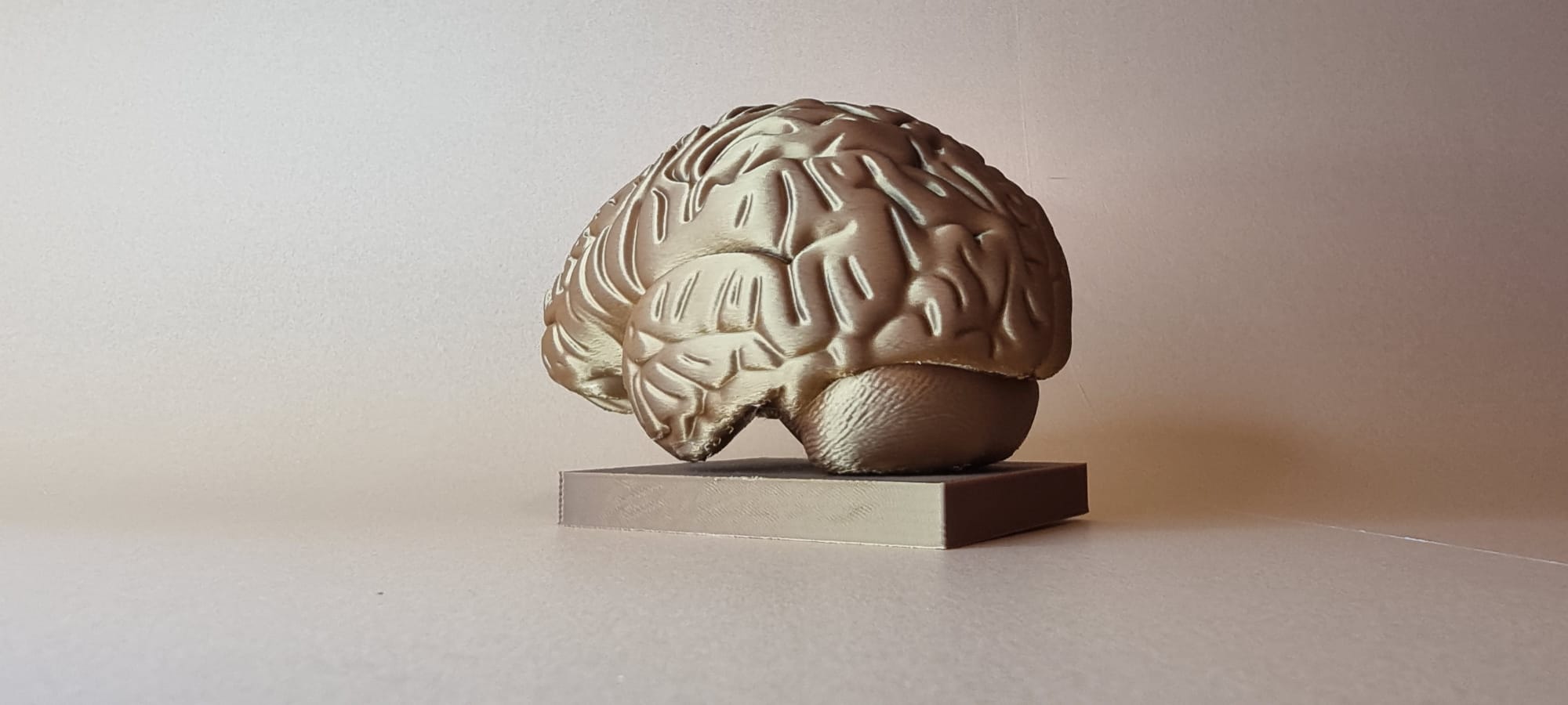 Brain — thumbnail 3