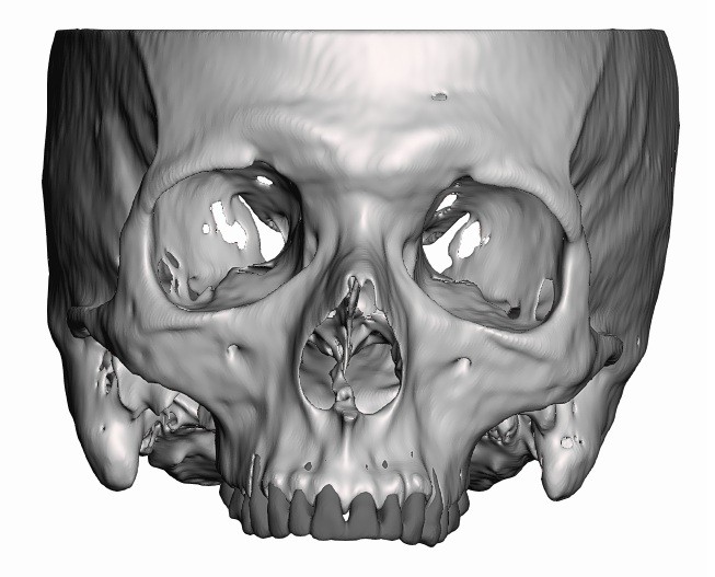 human maxilla