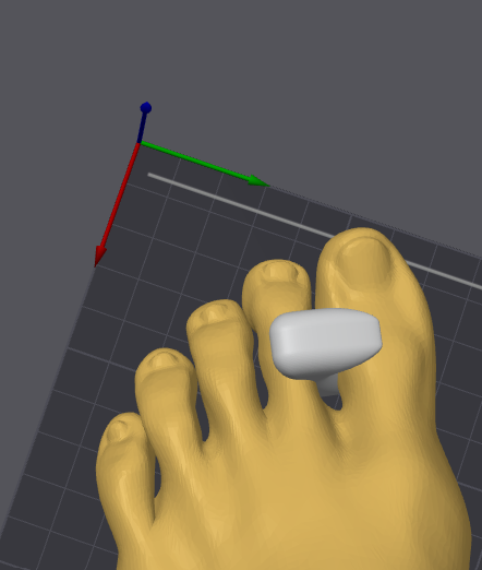 Bunion Corrector — miniatura 2