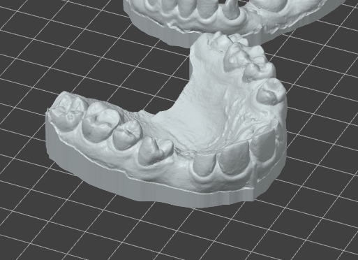 teeth — miniatura 2