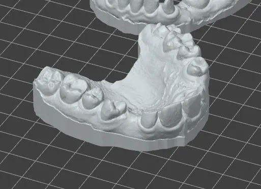 teeth by Levy Guttman | Download free STL model | Printables.com
