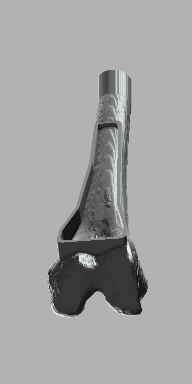 Distal Femur IO Trainer