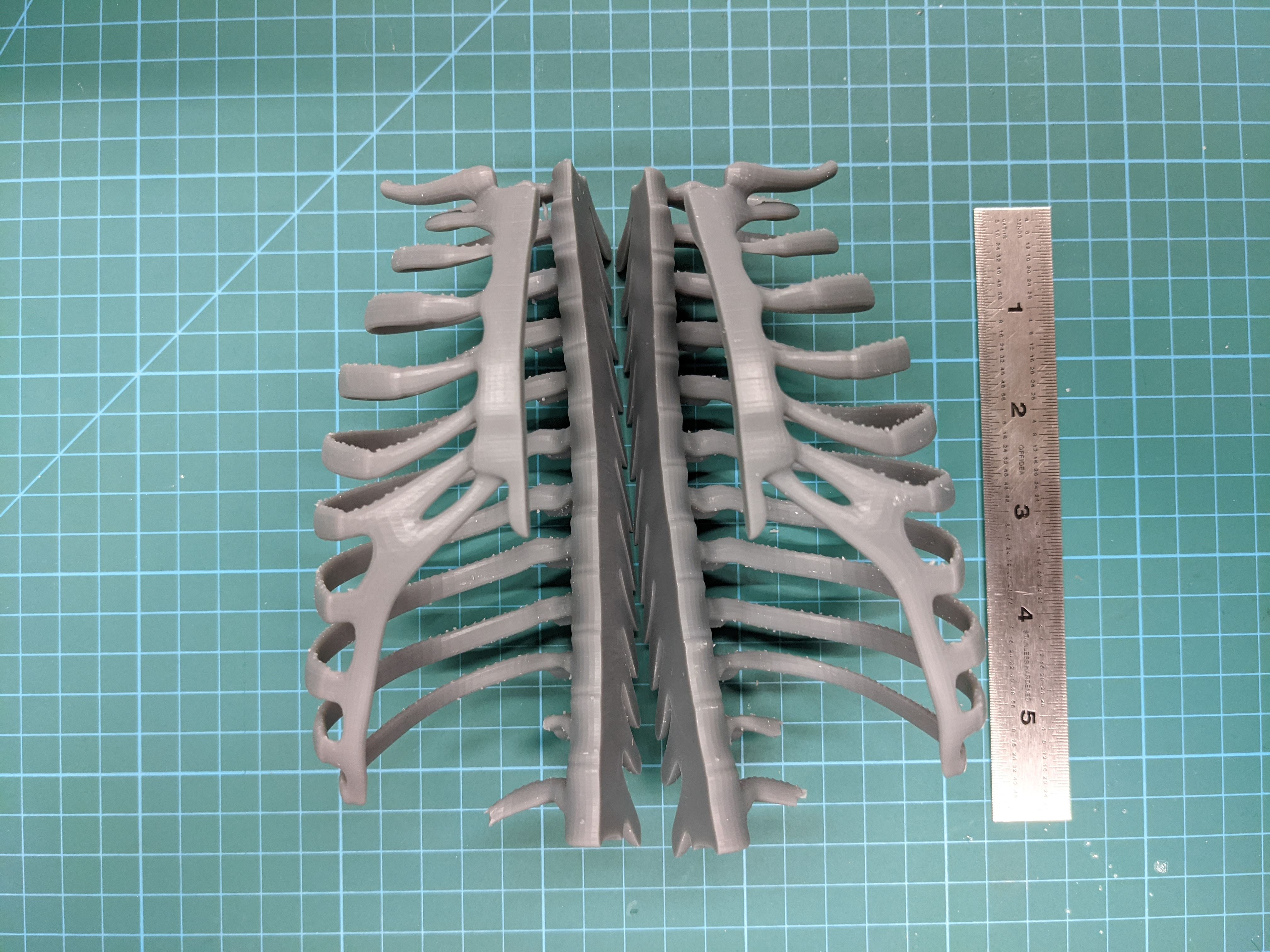 Neonatal Ribcage