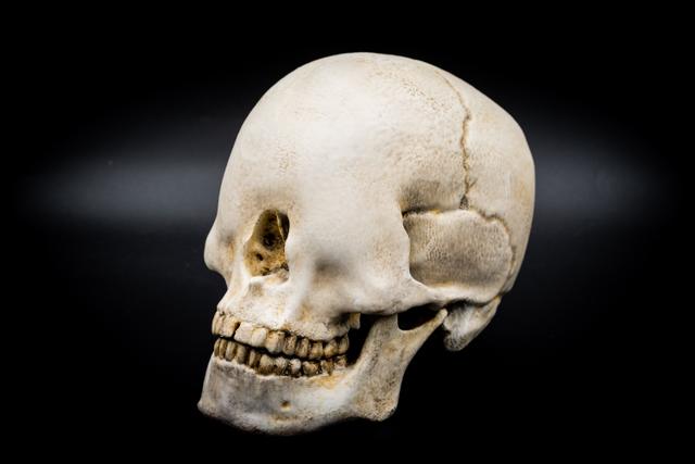 Blind Skull (Pre Supported) — miniatura 3