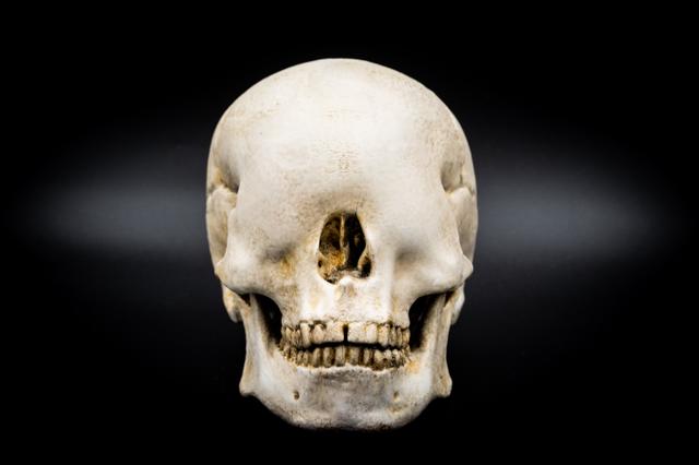 Blind Skull (Pre Supported) — miniatura 2