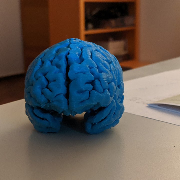 MyBrain — thumbnail 2