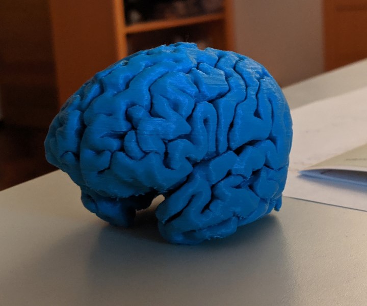 MyBrain