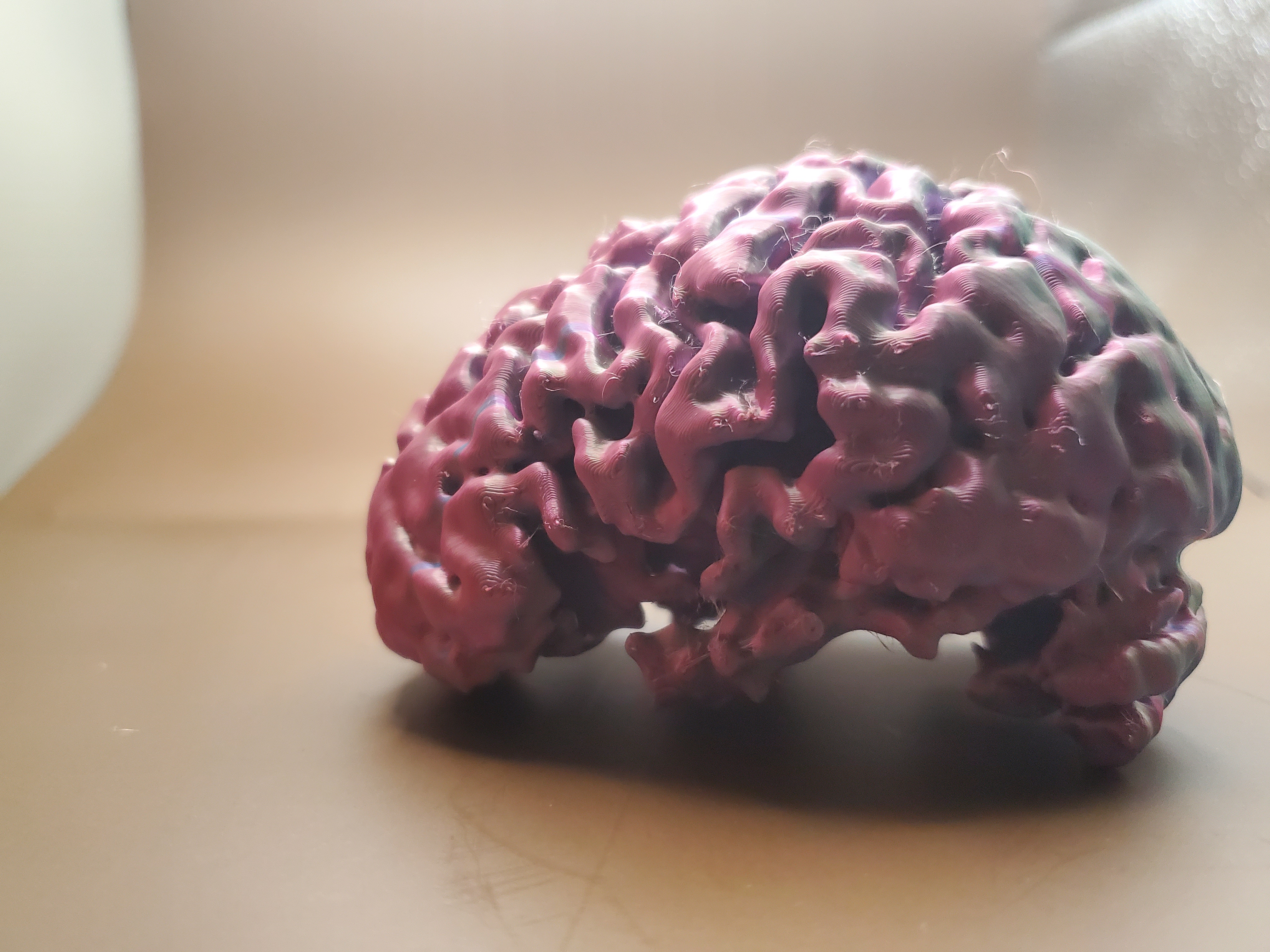 Brain (MRI Scan)