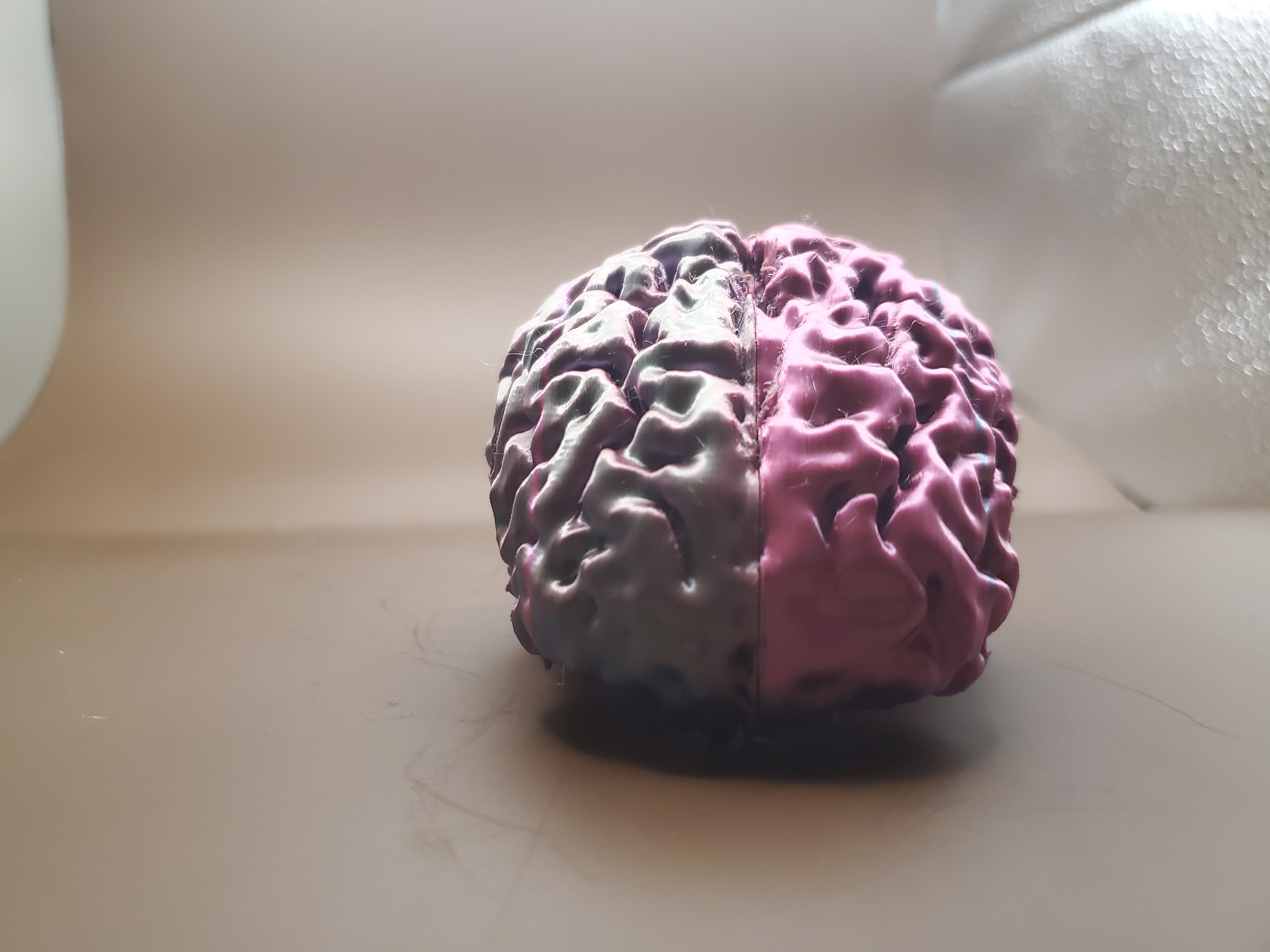 Brain (MRI Scan) — miniatura 4