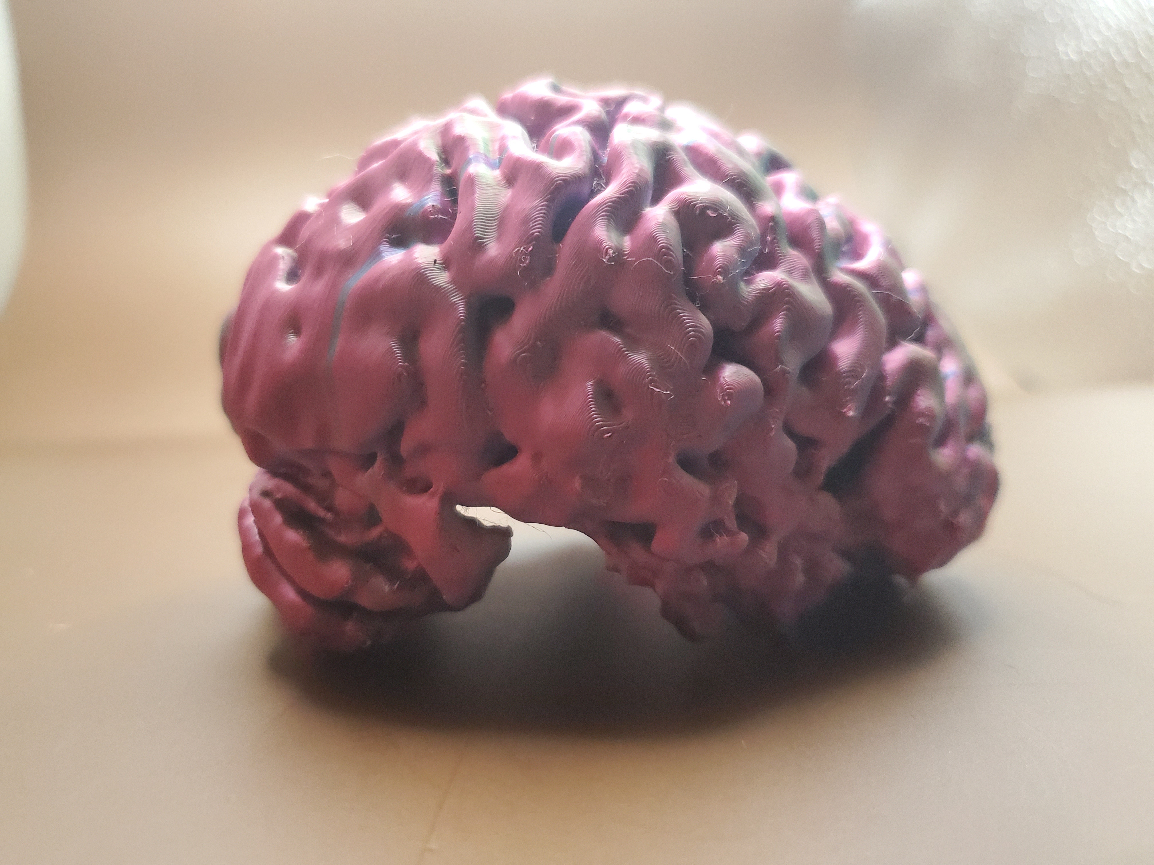 Brain (MRI Scan) — miniatura 2