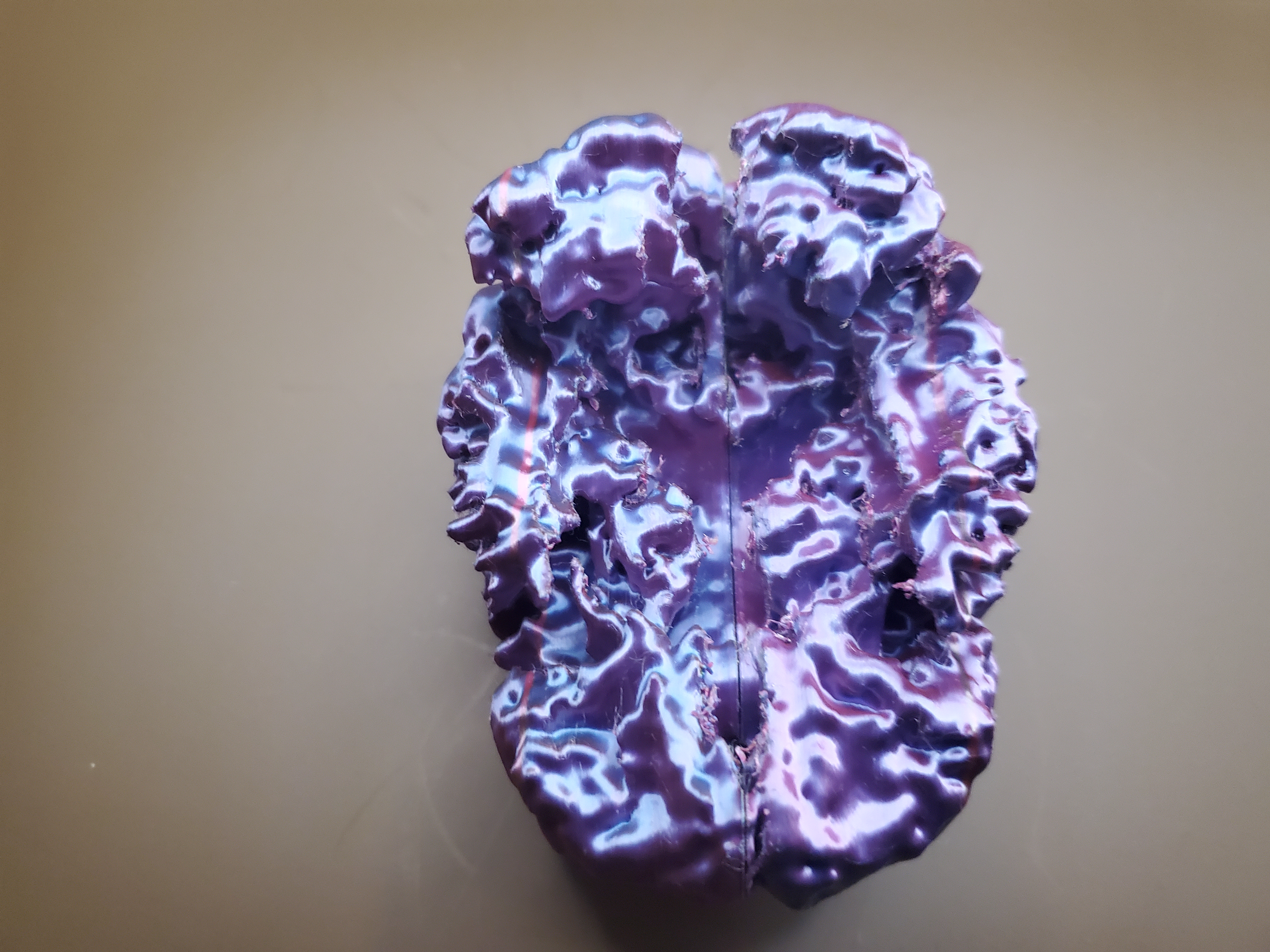 Brain (MRI Scan) — miniatura 5