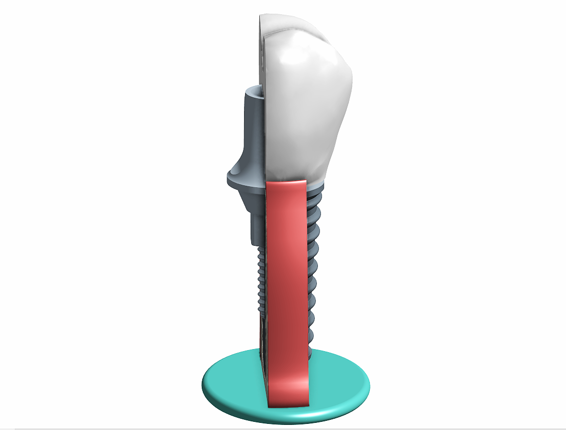 Miniatura 10 do modelo 3D Tooth implant model