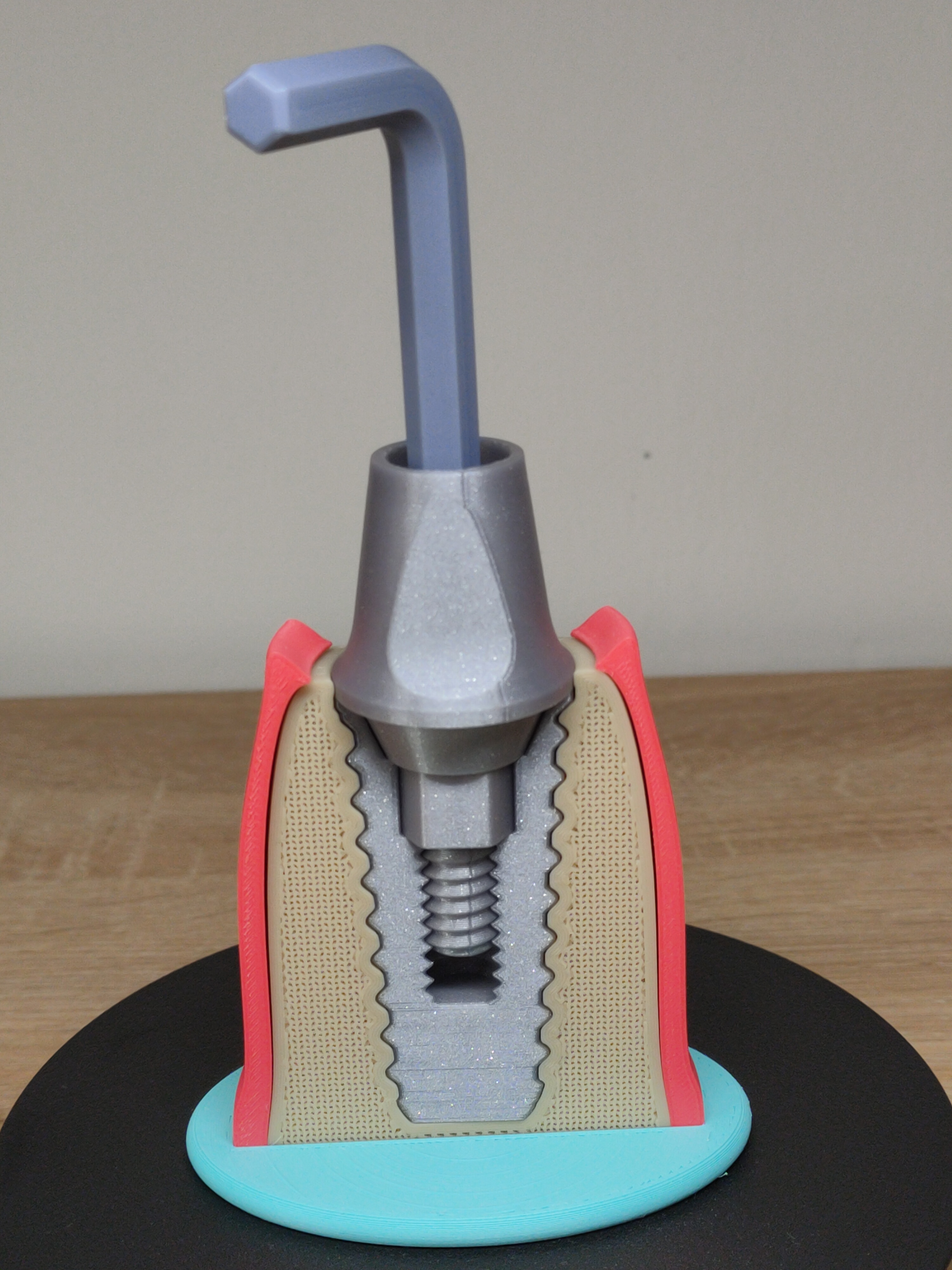 Miniatura 4 do modelo 3D Tooth implant model
