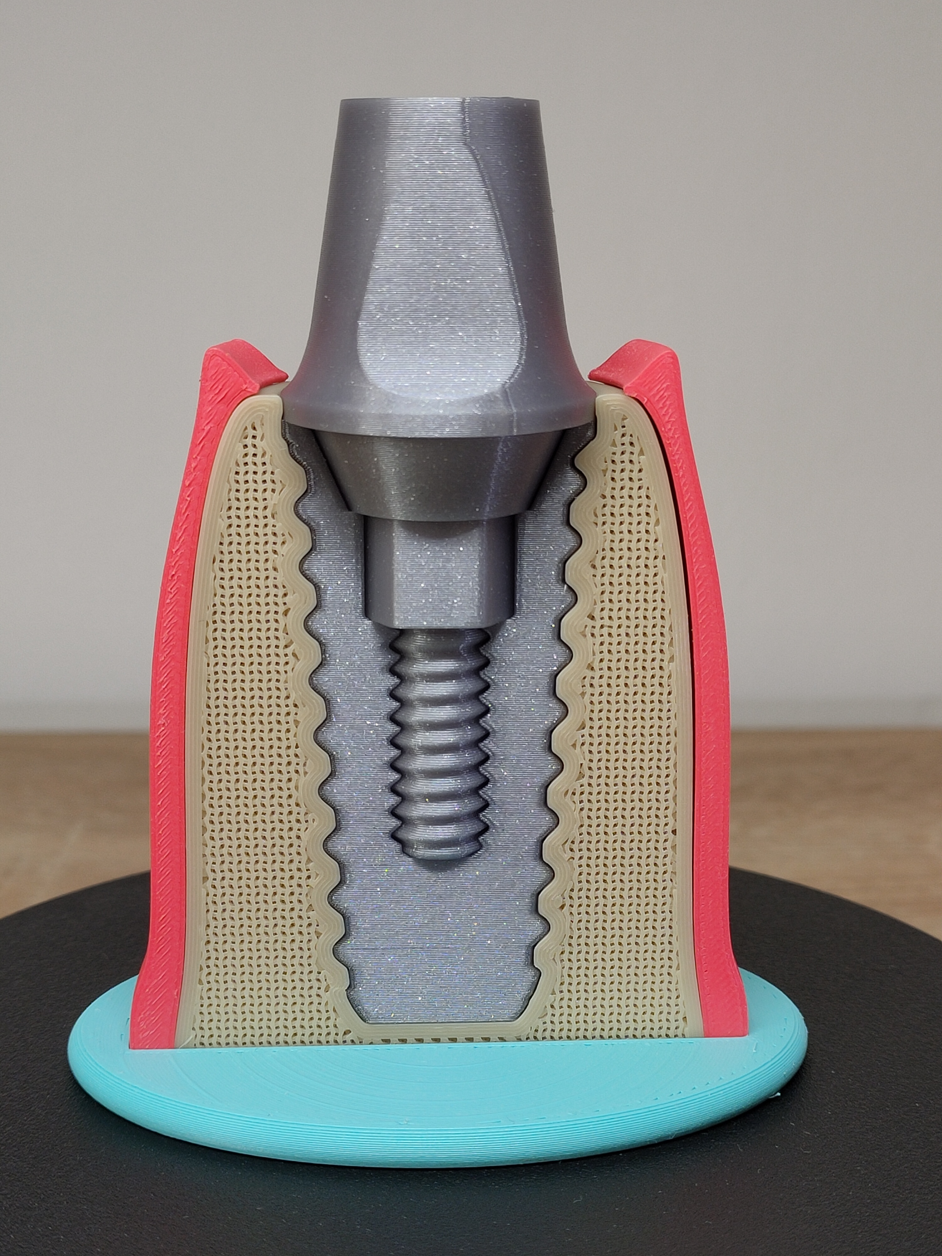 Miniatura 5 do modelo 3D Tooth implant model