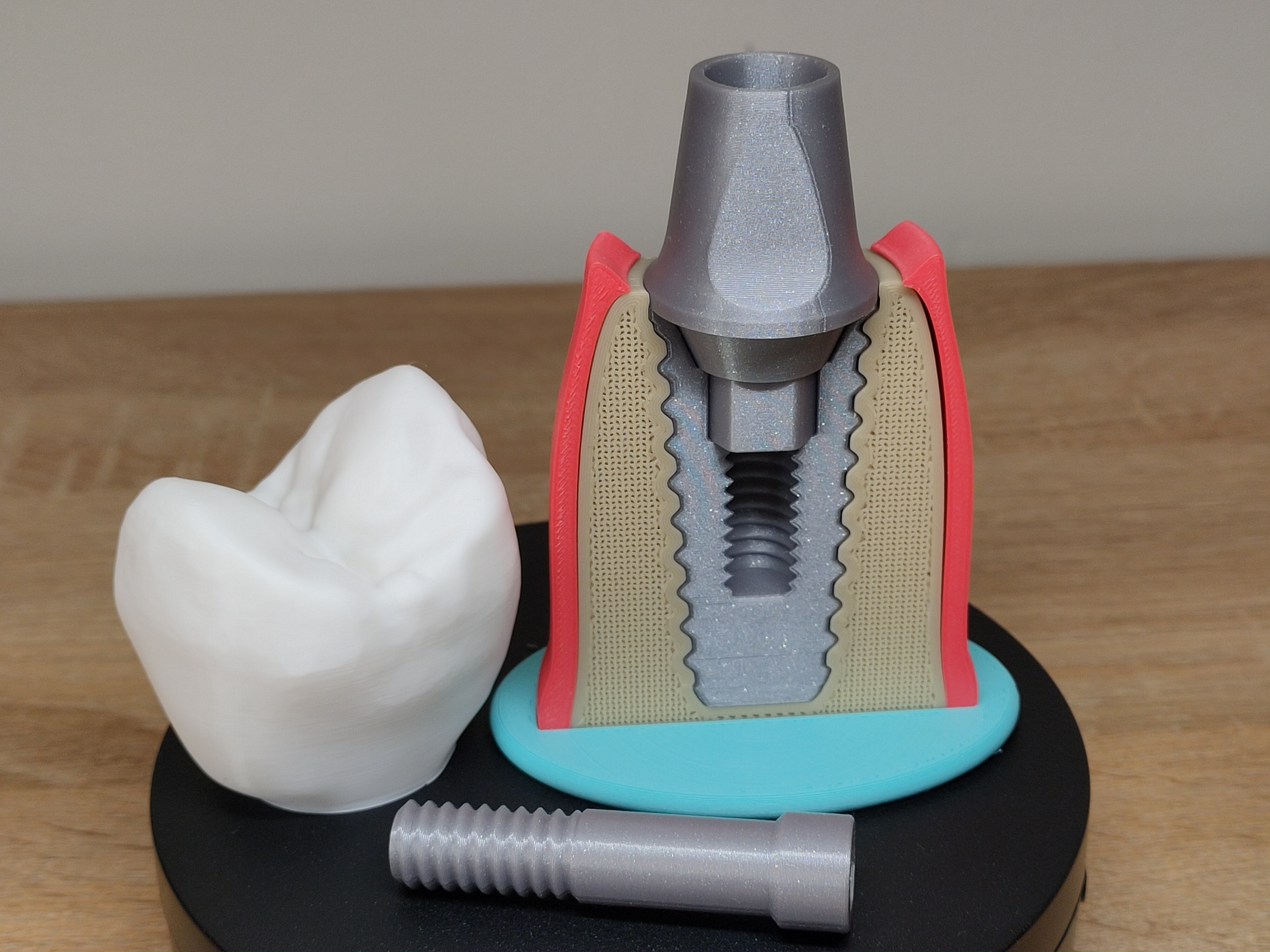 Miniatura 7 do modelo 3D Tooth implant model
