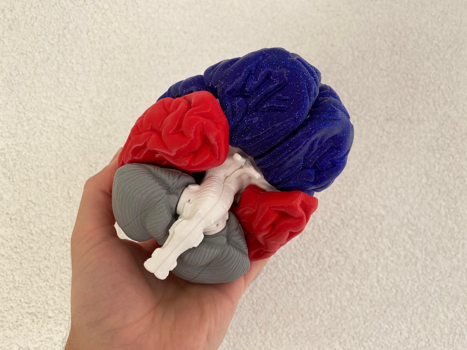 Brain