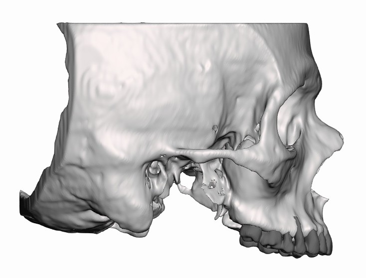human maxilla — thumbnail 2