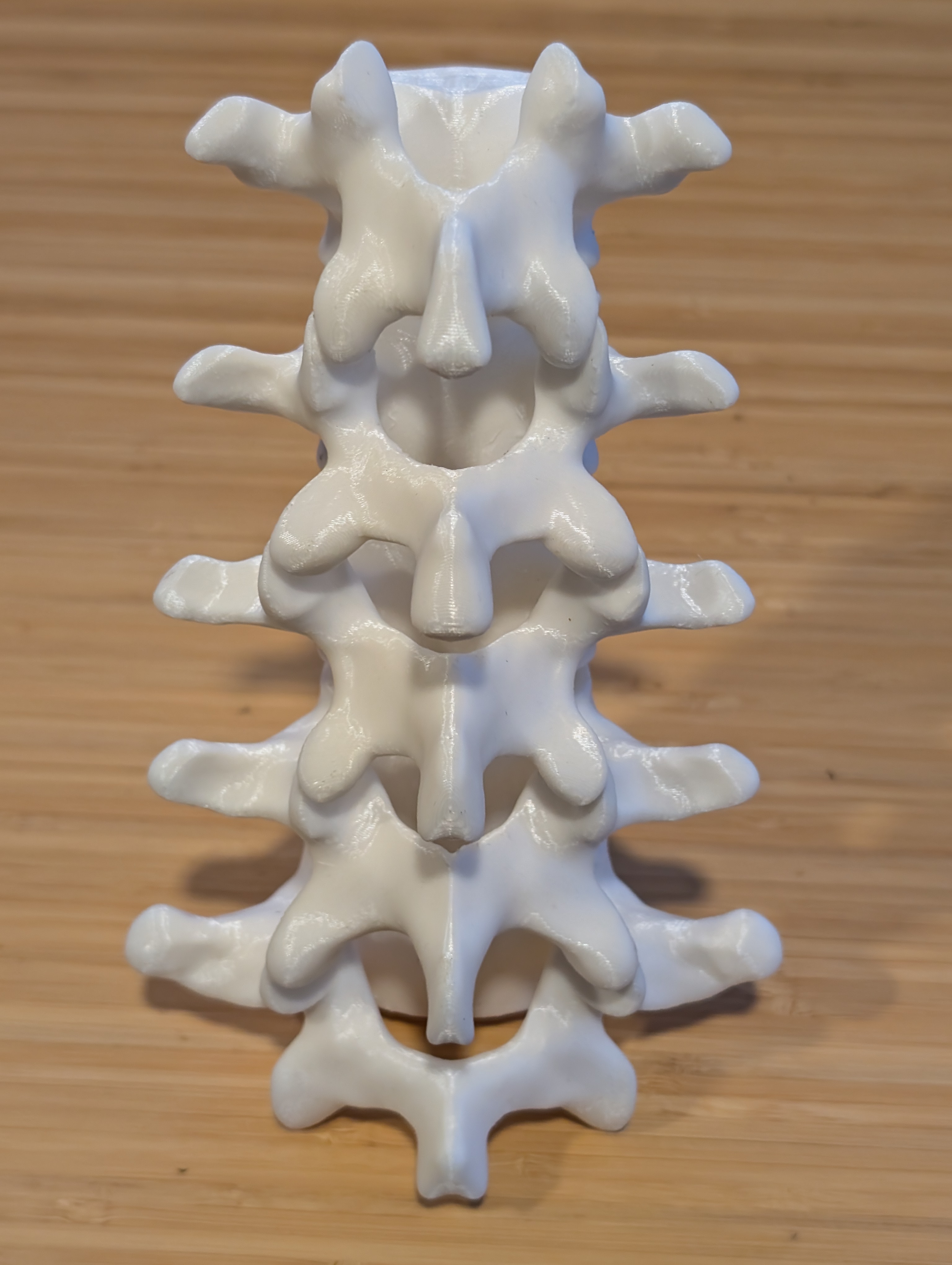 Lumbar vertebrae