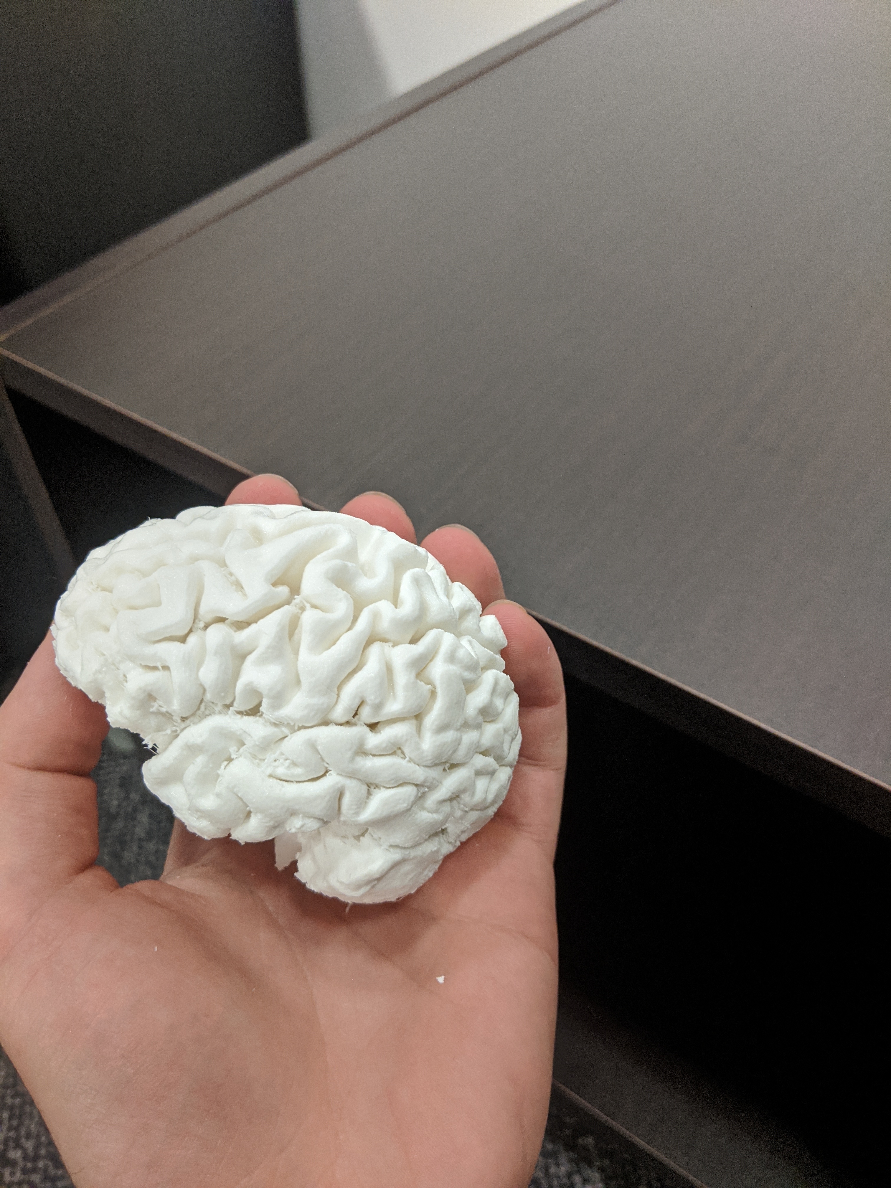 Brain MRI Scan