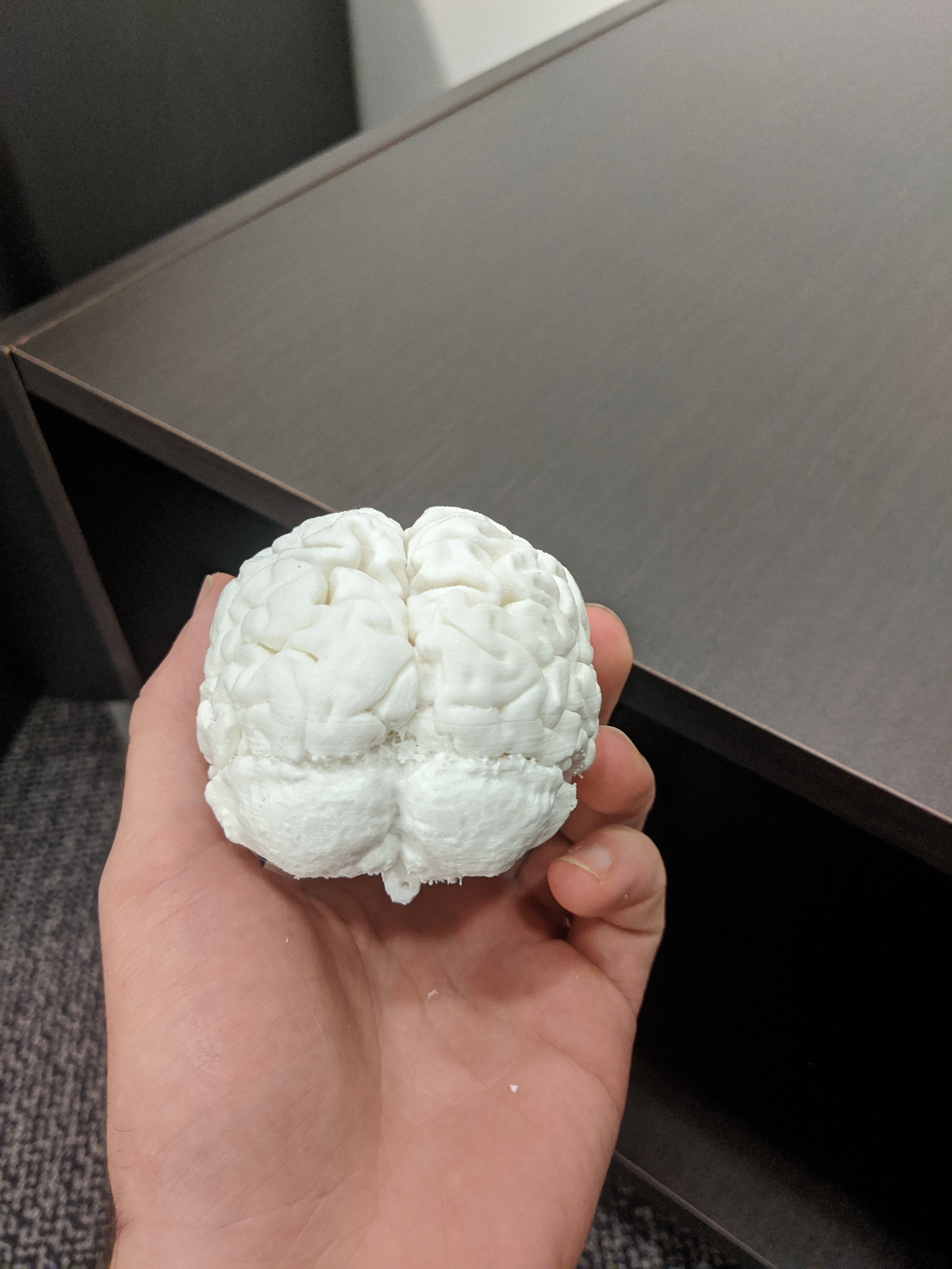 Brain MRI Scan — miniatura 2