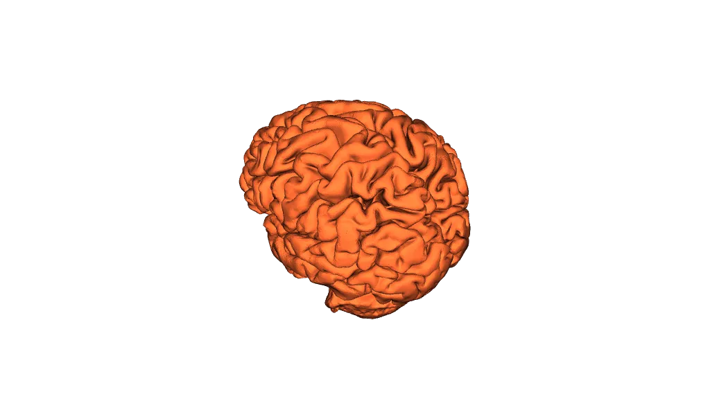Brain MRI Scan by jassca | Download free STL model | Printables.com