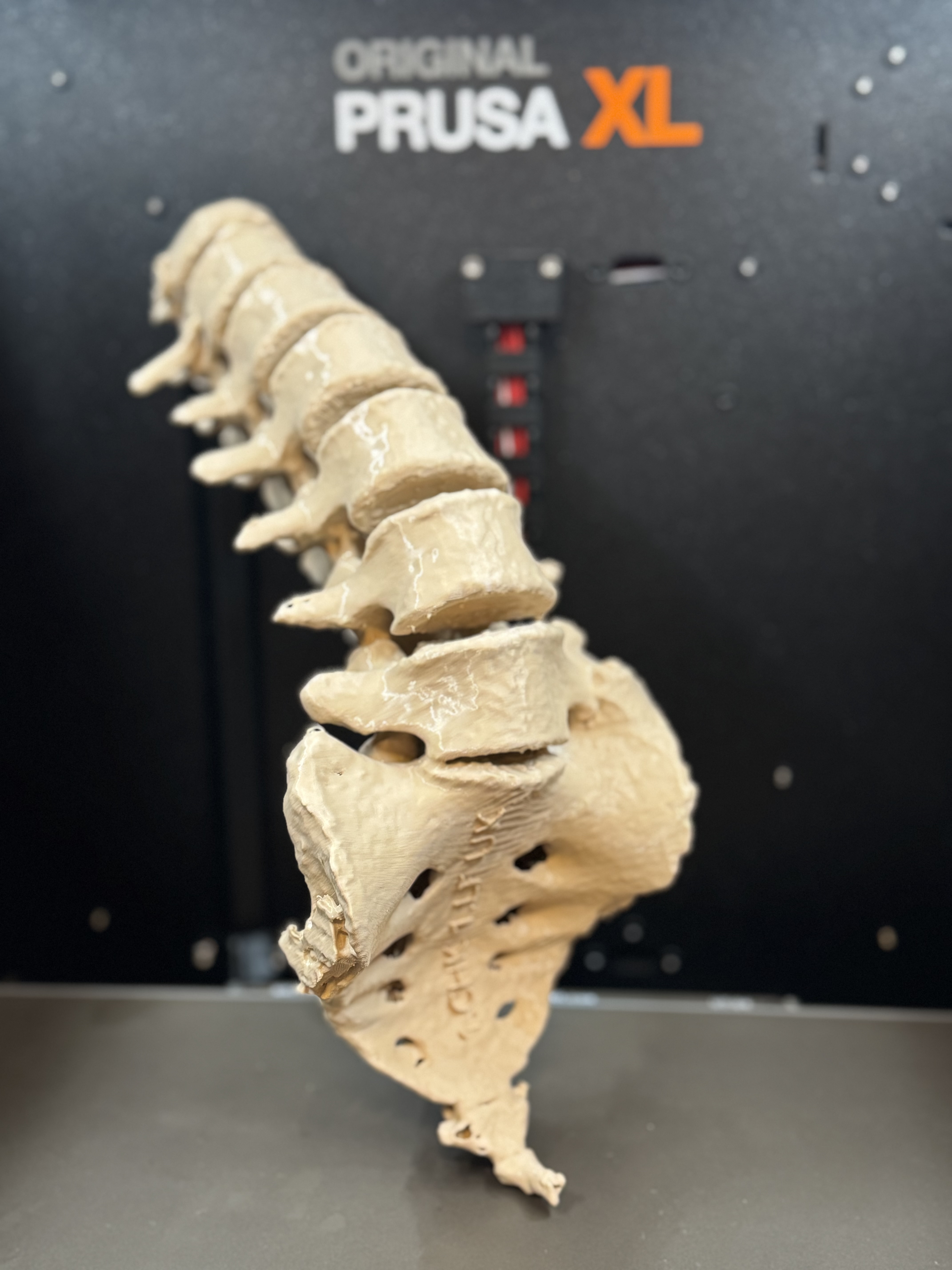 Sacrum with spine