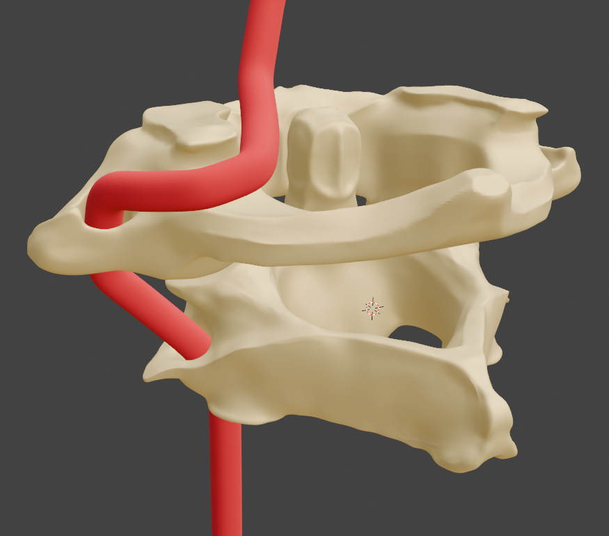 Atlas and Axis (C1 and C2) Cervical Vertebrae