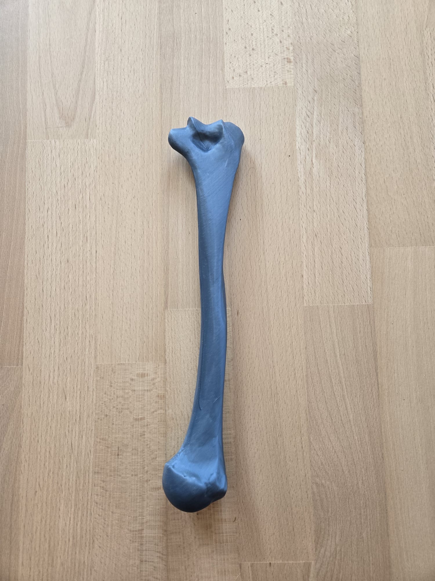 Humerus Bone Left — thumbnail 3