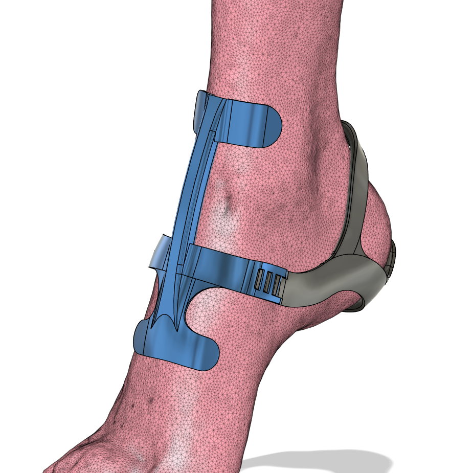 Ankle Cage V2 by eekfly | Download free STL model | Printables.com