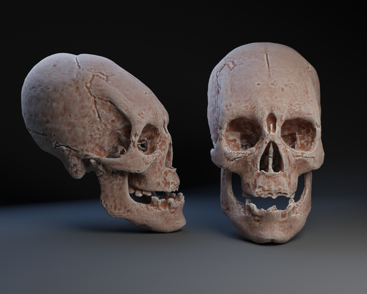 Skull: Artificial cranial deformation in Tiwanaku