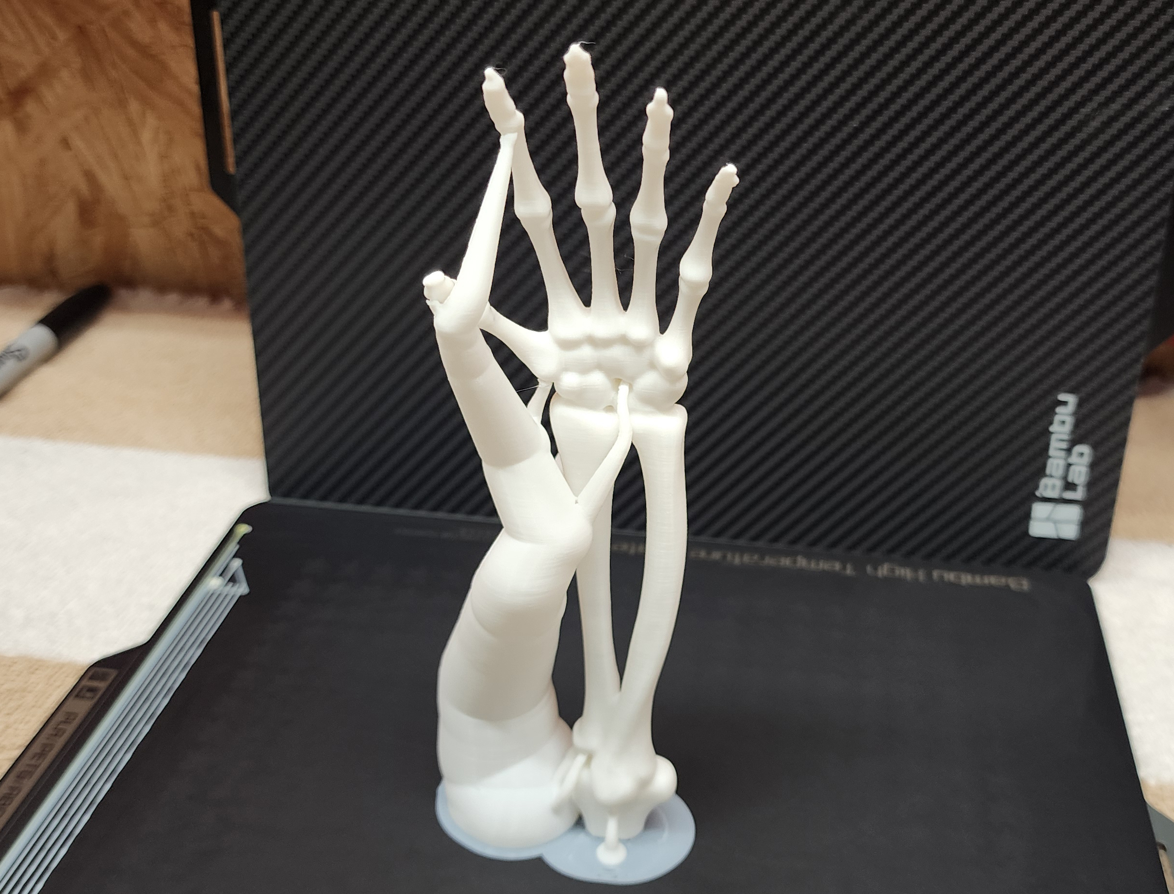 Skeletal Forearm & Hand — thumbnail 3