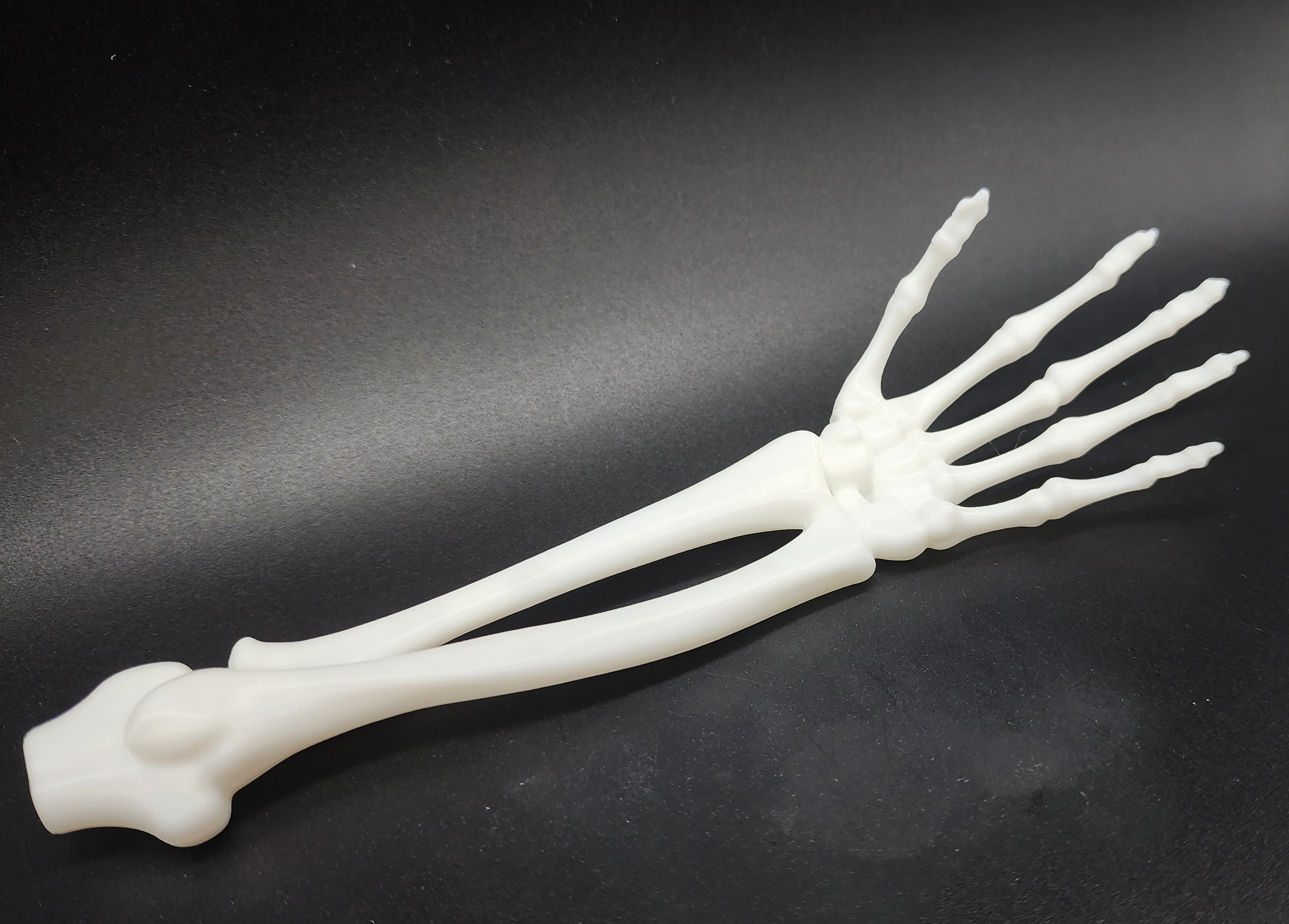 Skeletal Forearm & Hand — thumbnail 4