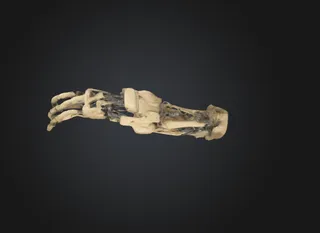 Arm