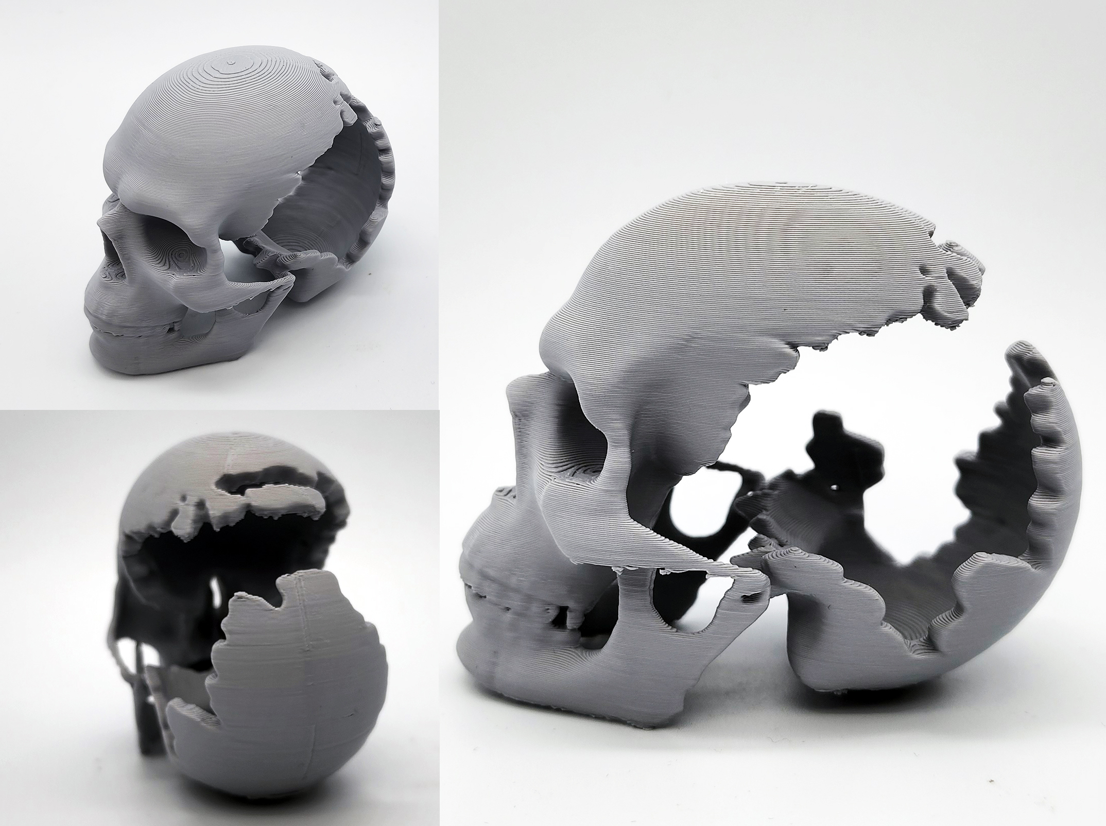 Gouged-Out Skull