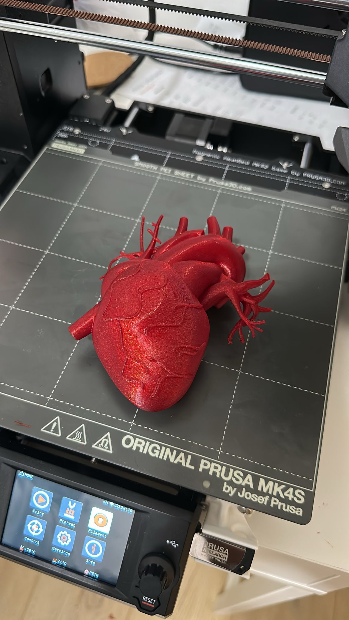 Human heart