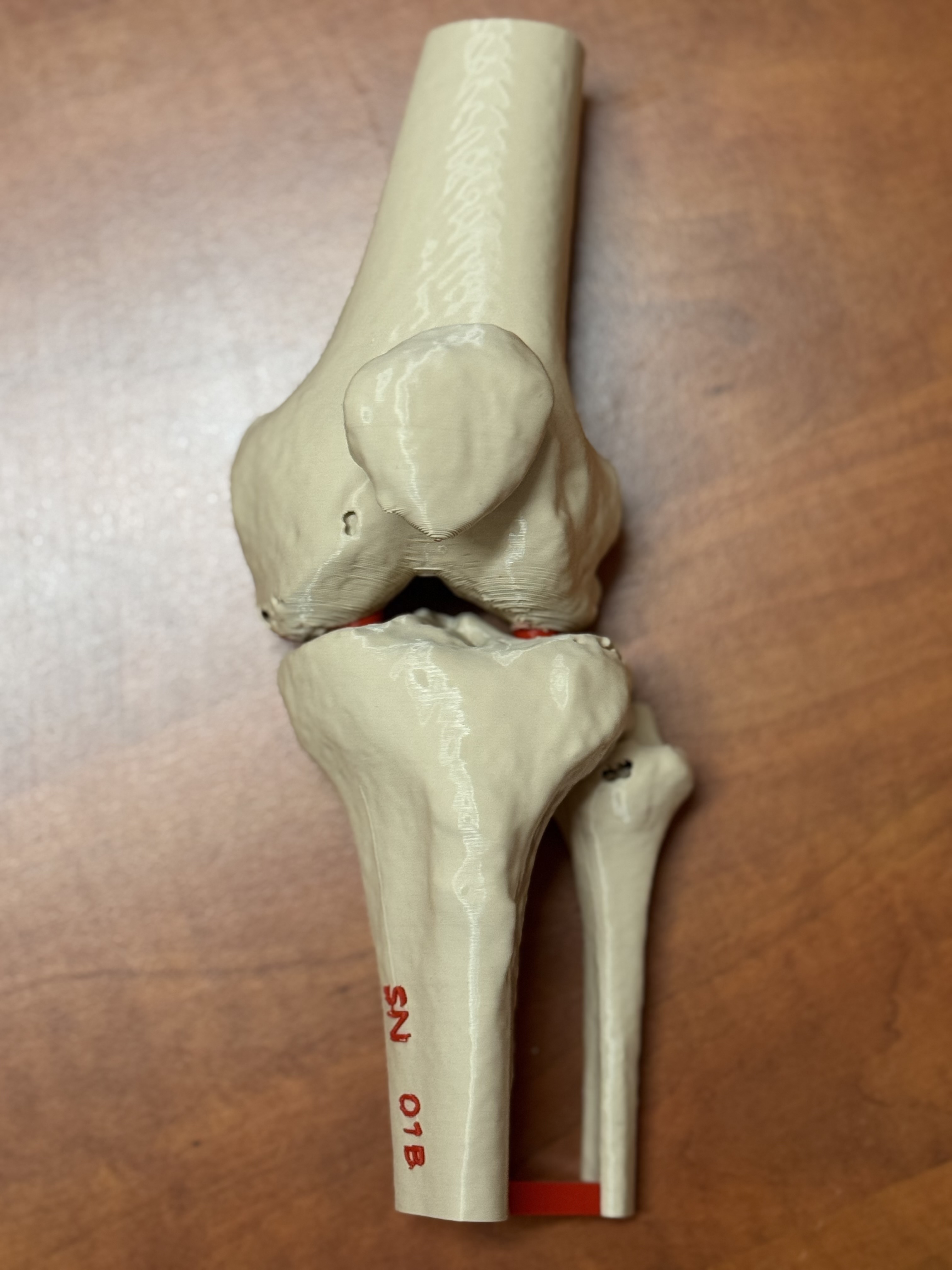 Human knee (distal femur, patella, proximal tibia, proximal fibula), anatomický model kolene