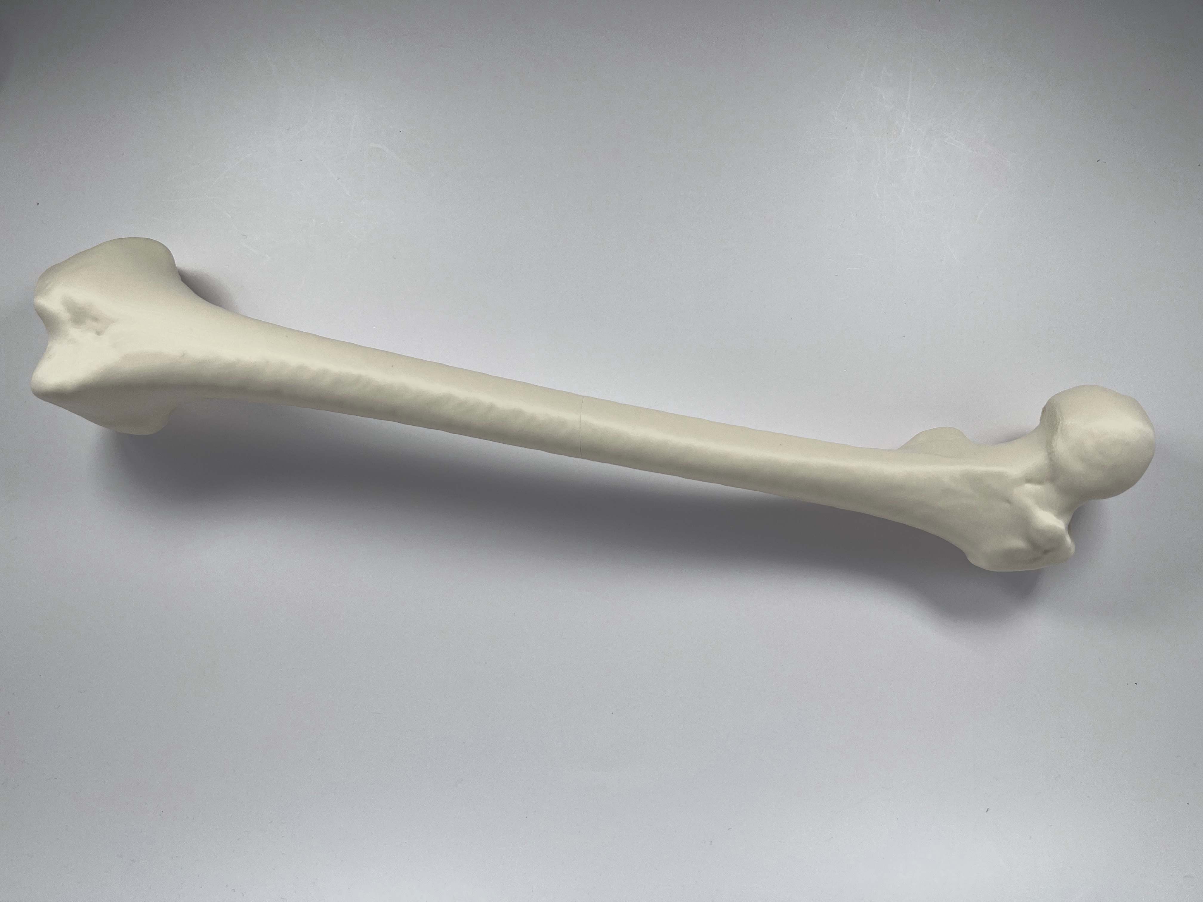 Left Human Femur