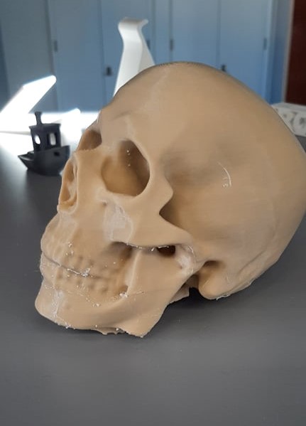 3D scanned Human Skull