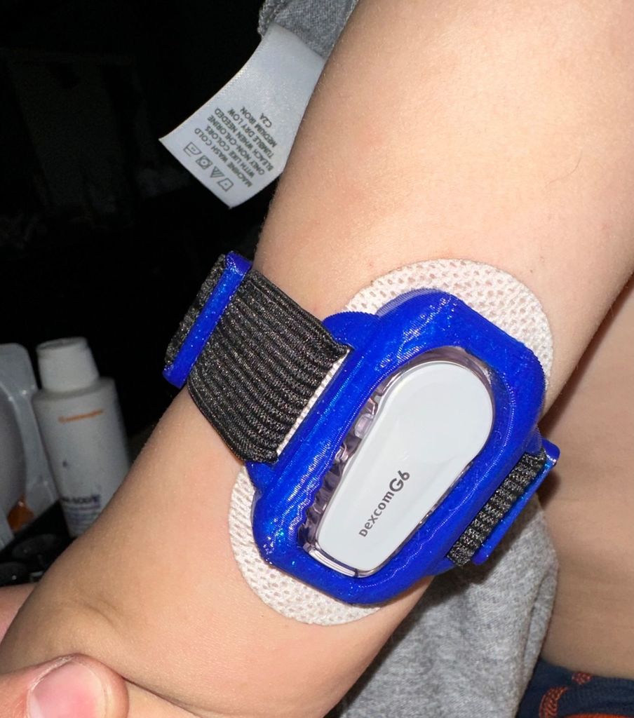 Dexcom G6