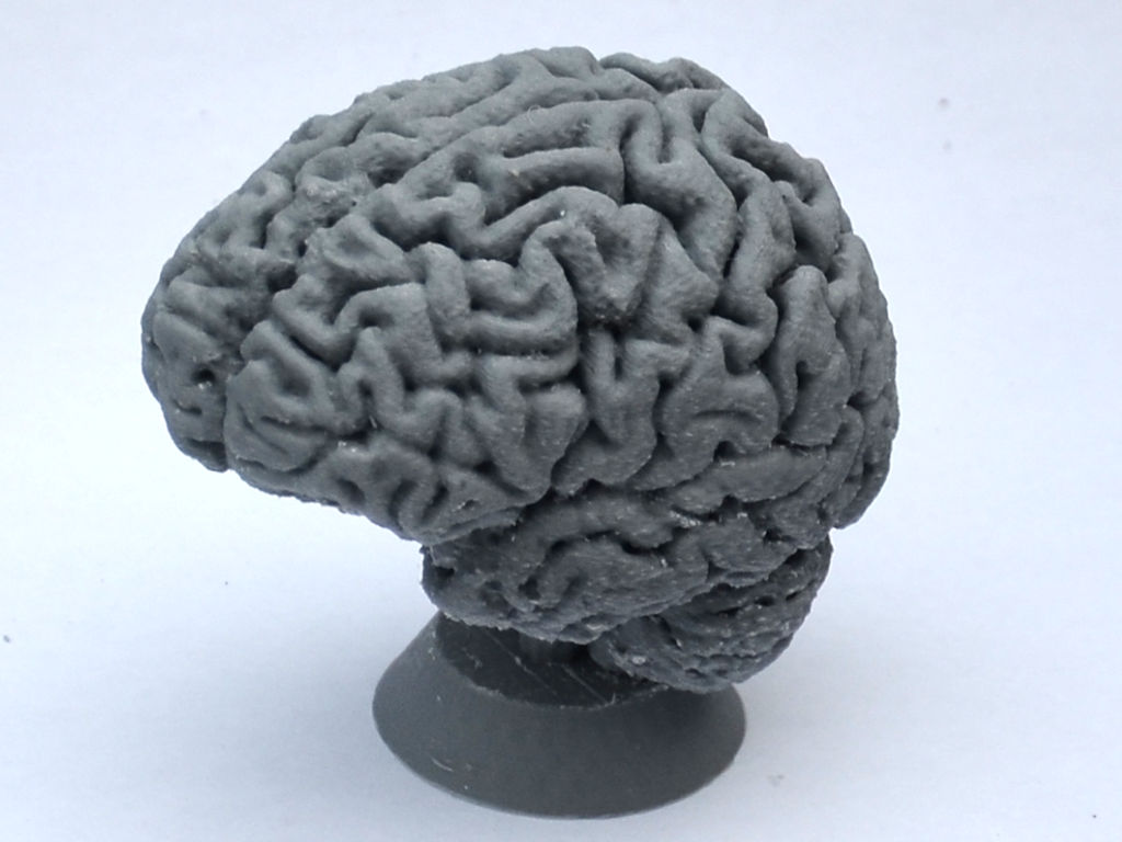 Human Brain