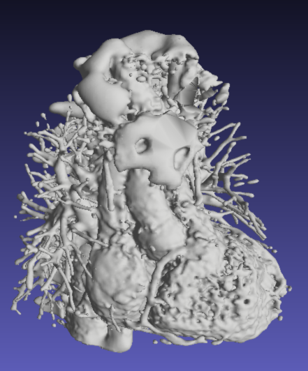 Human heart