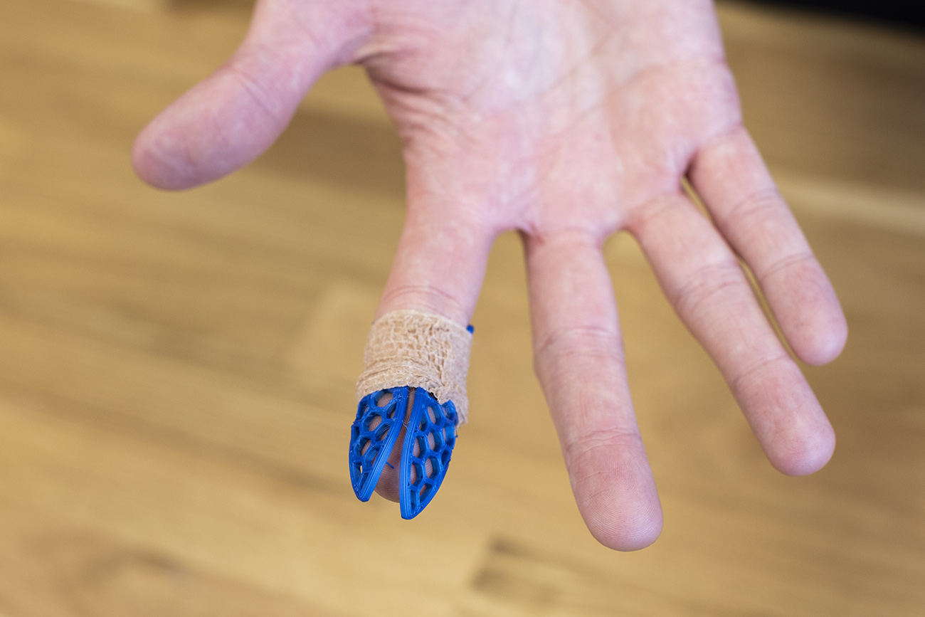 Finger extension brace (splint) by Prusa Research Download free STL