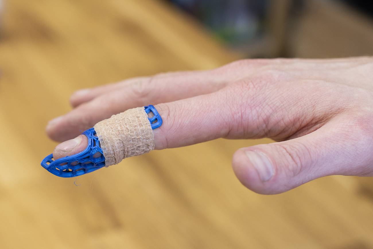 Finger extension brace (splint) by Prusa Research | Download free STL ...