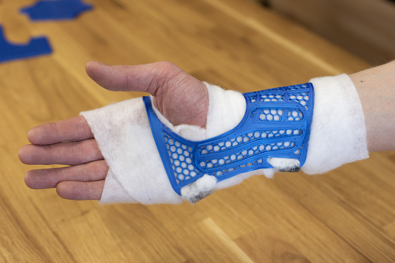 Wrist brace (splint) a lighter version by Prusa Research Download