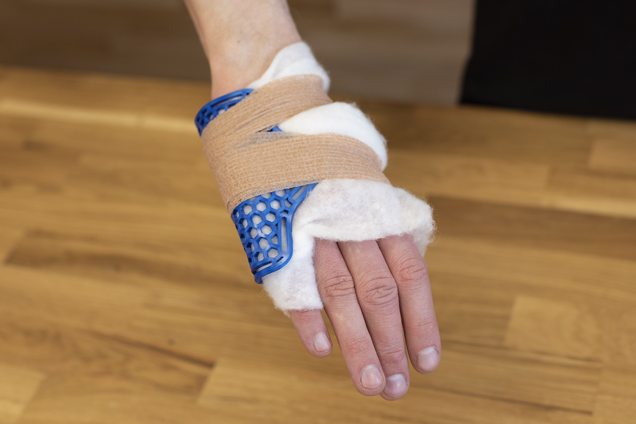 Pinky finger/thumb brace (splint) by Prusa Research | Download free STL