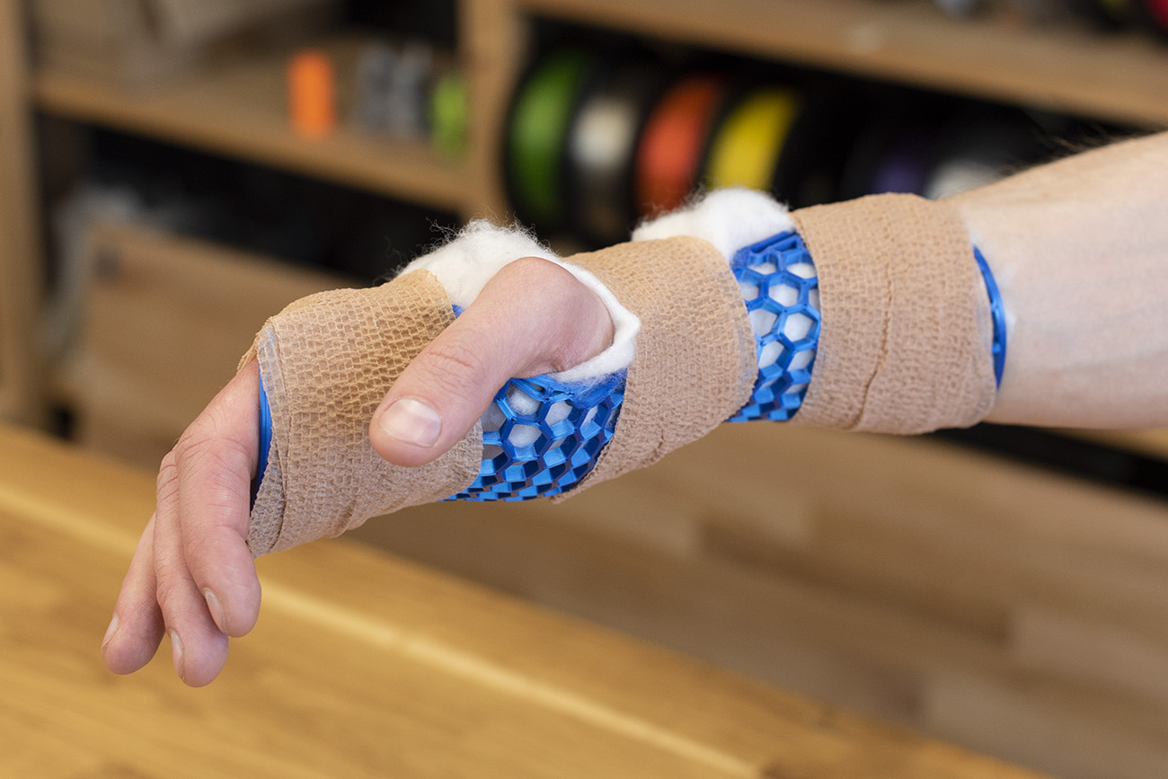 Palm brace (splint)