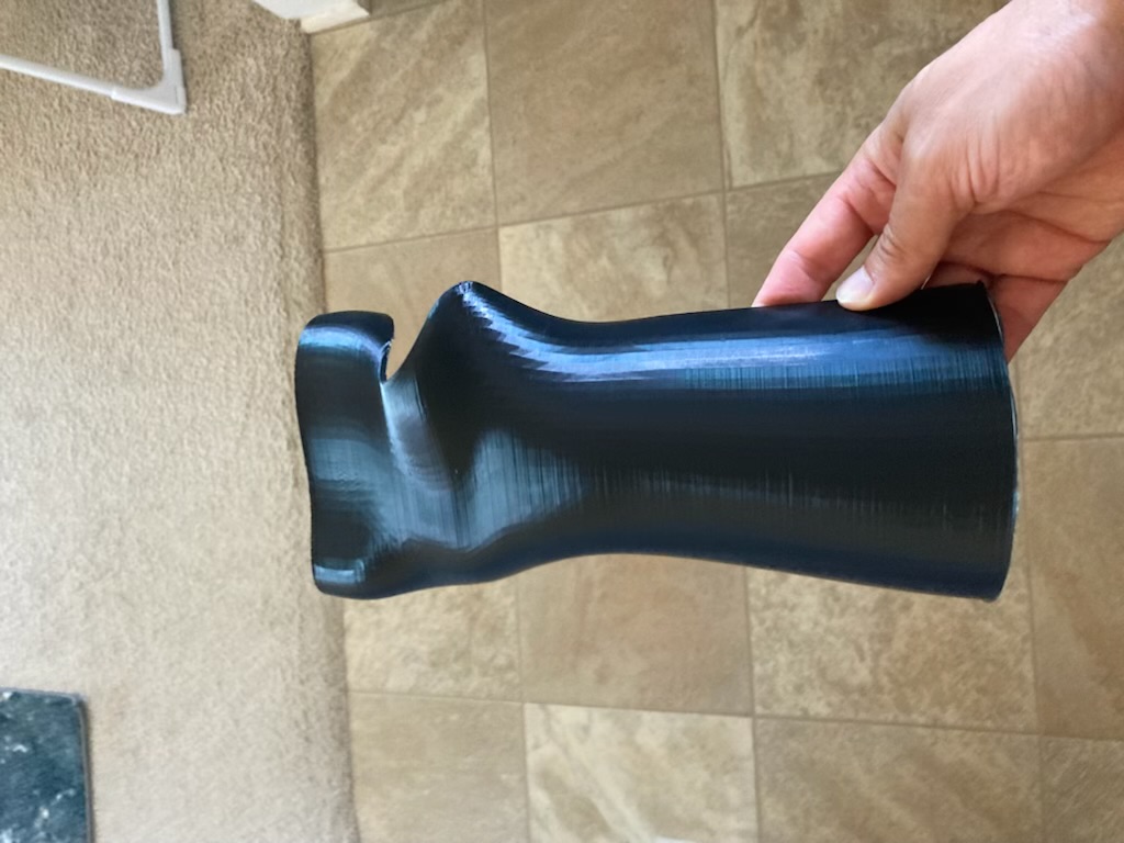 wrist splint volar based