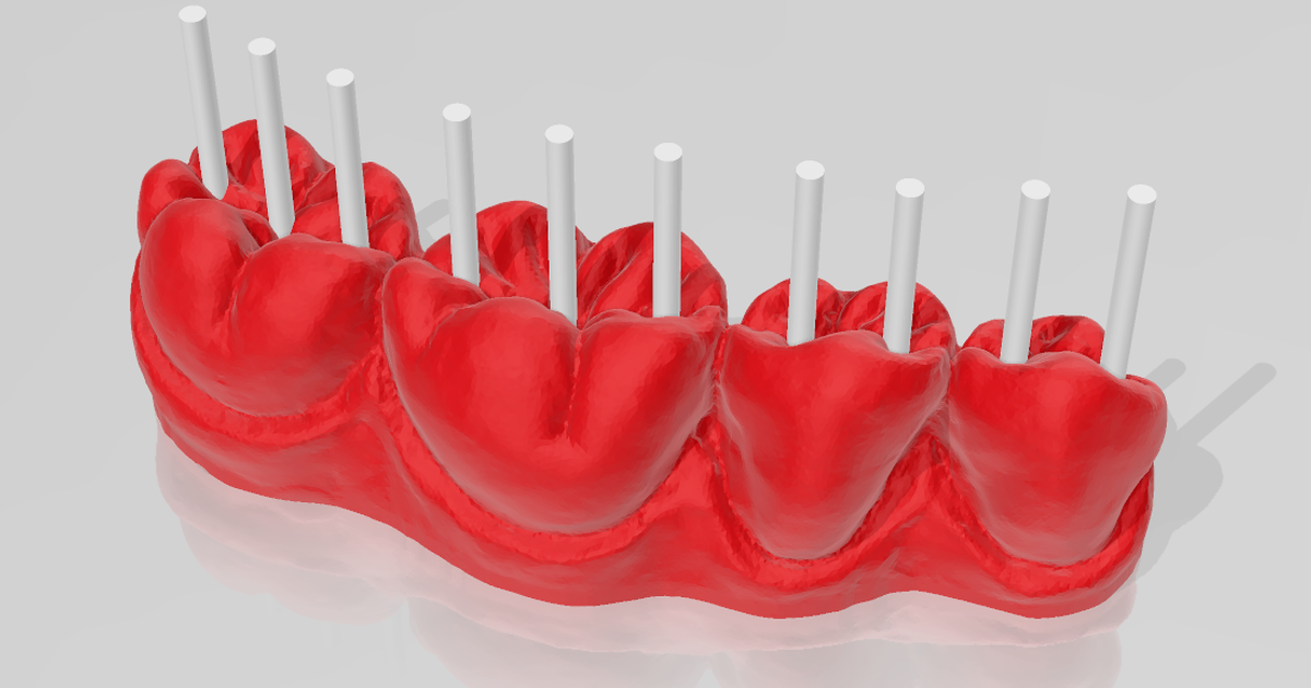 Dental pen holder by Thorin Oakenshield, Download free STL model
